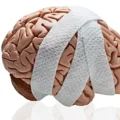 cropped brain bandage.webp